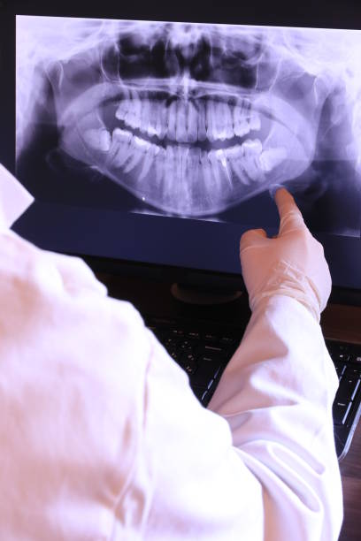 Best Emergency Gum Treatment in Oak Park, CA